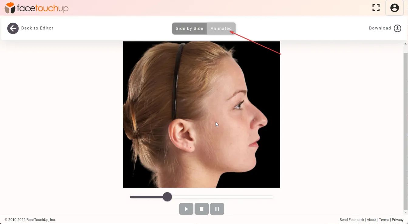 FaceTouchUp rhinoplasty simulator - Step 6: Fine-tune the nose profile
