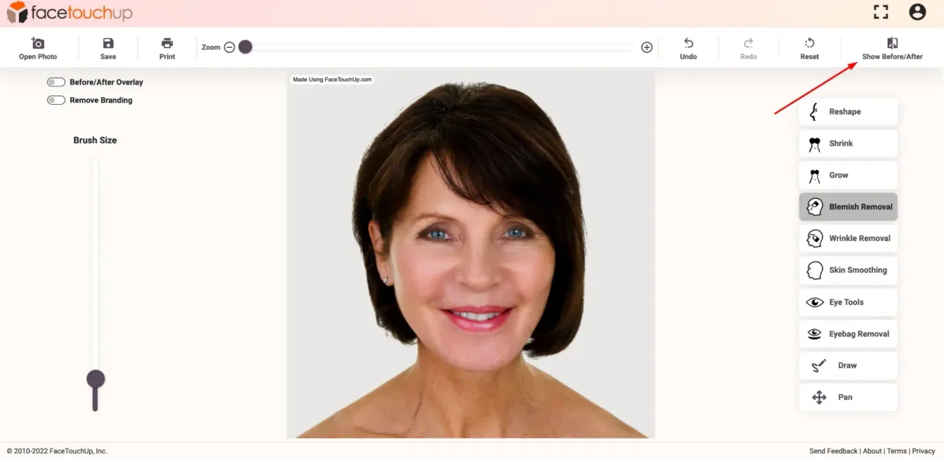 FaceTouchUp face lift simulator - Step 11: Review before and after comparison