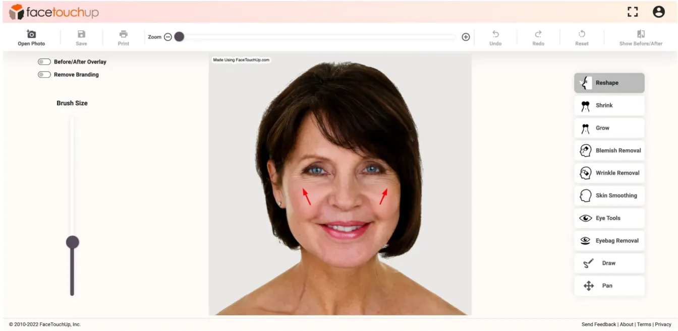 FaceTouchUp face lift simulator - Step 5: Smooth nasolabial folds