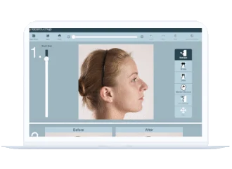 FaceTouchUp pour les consultations à distance