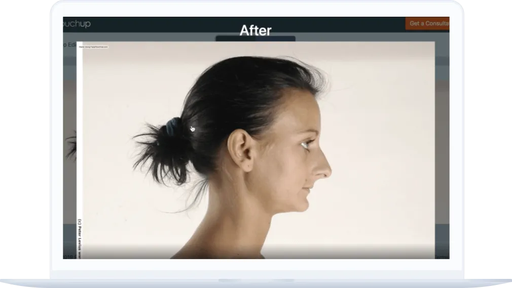 FaceTouchUp plastic surgery simulator tutorial screenshot