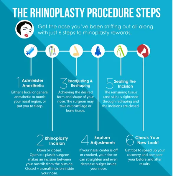 Rhinoplasty Steps