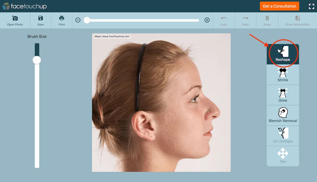Virtual nose job simulation - First step of rhinoplasty visualization