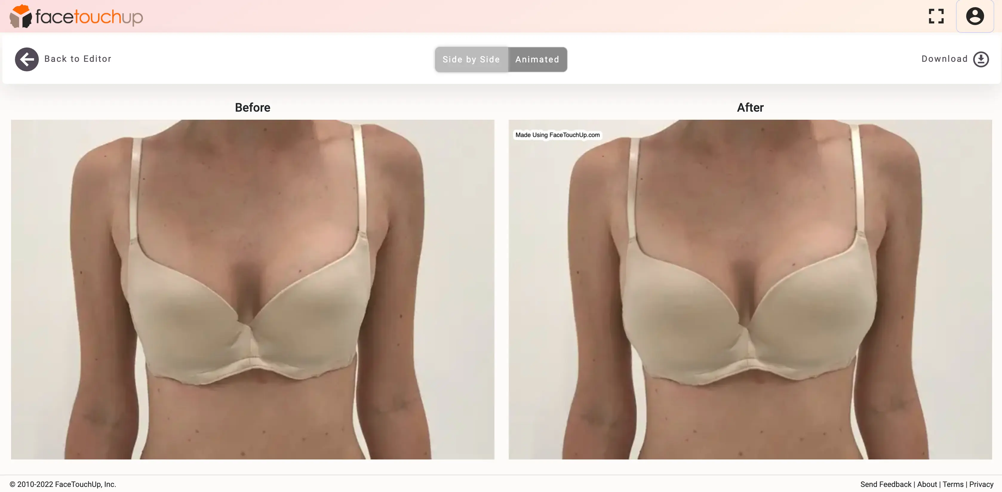 How to simulate breast augmentation step 8