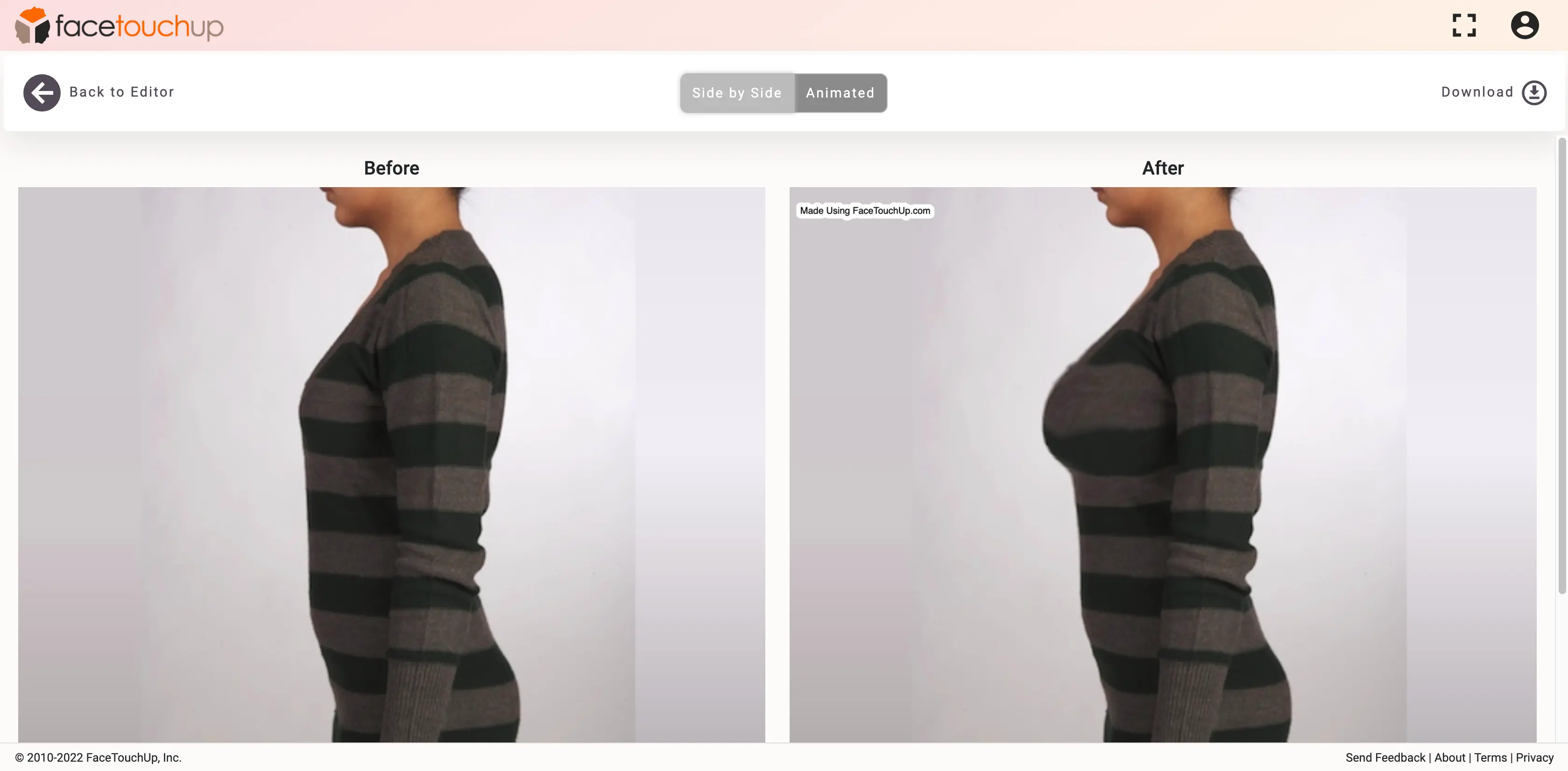How to simulate breast augmentation step 8