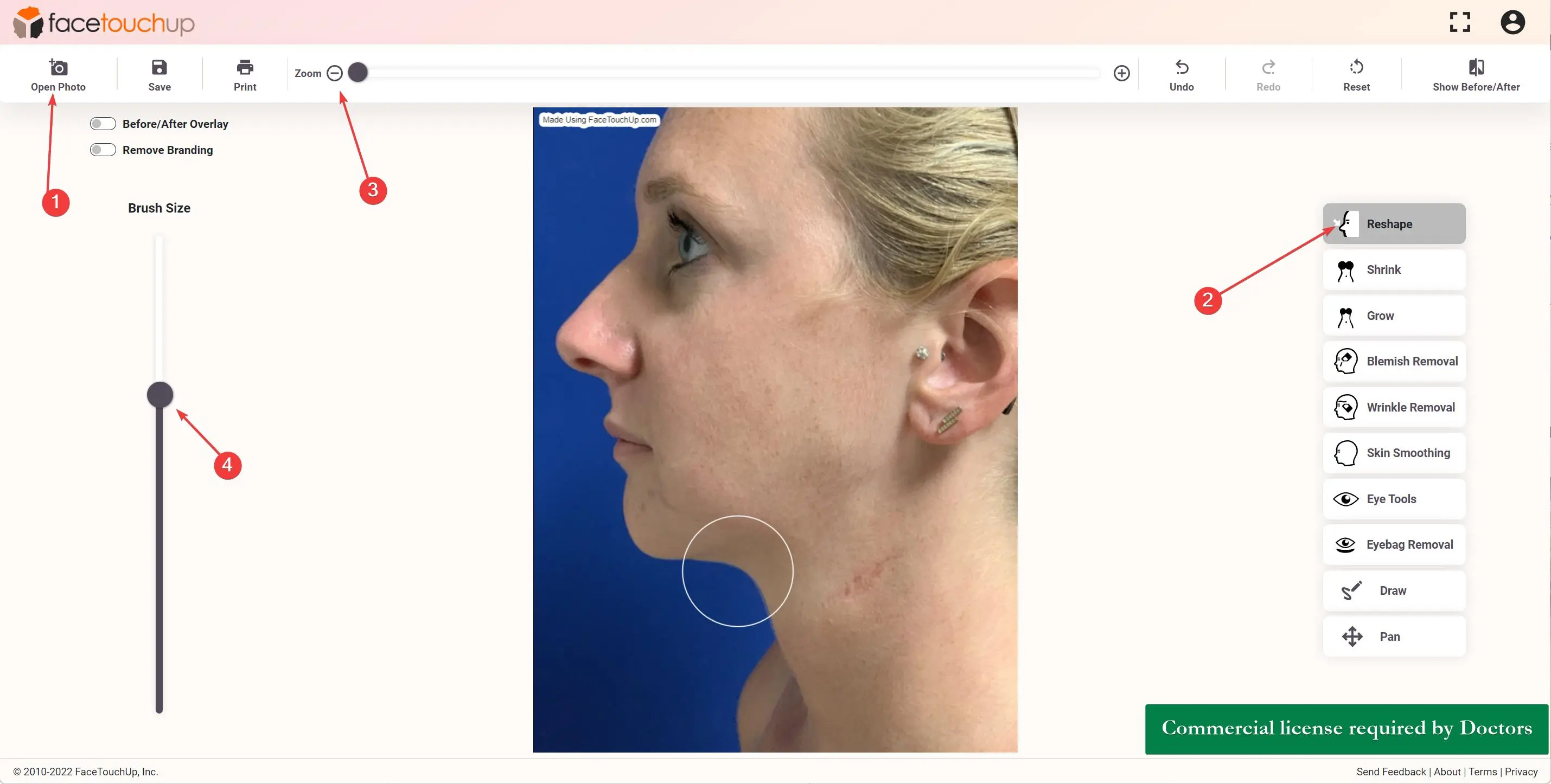 How to simulate chin and neck lift step 1