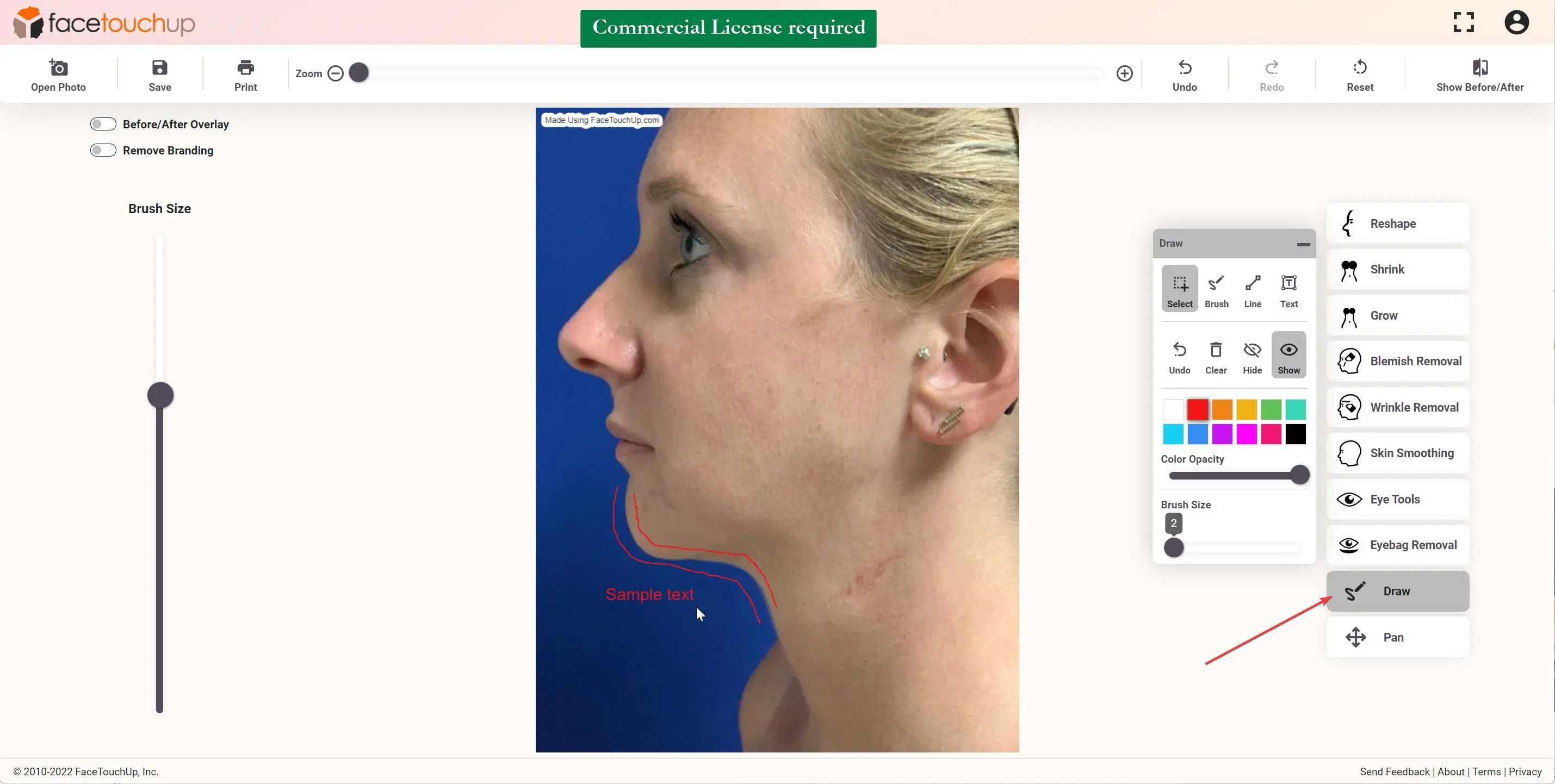 How to simulate chin and neck lift step 1