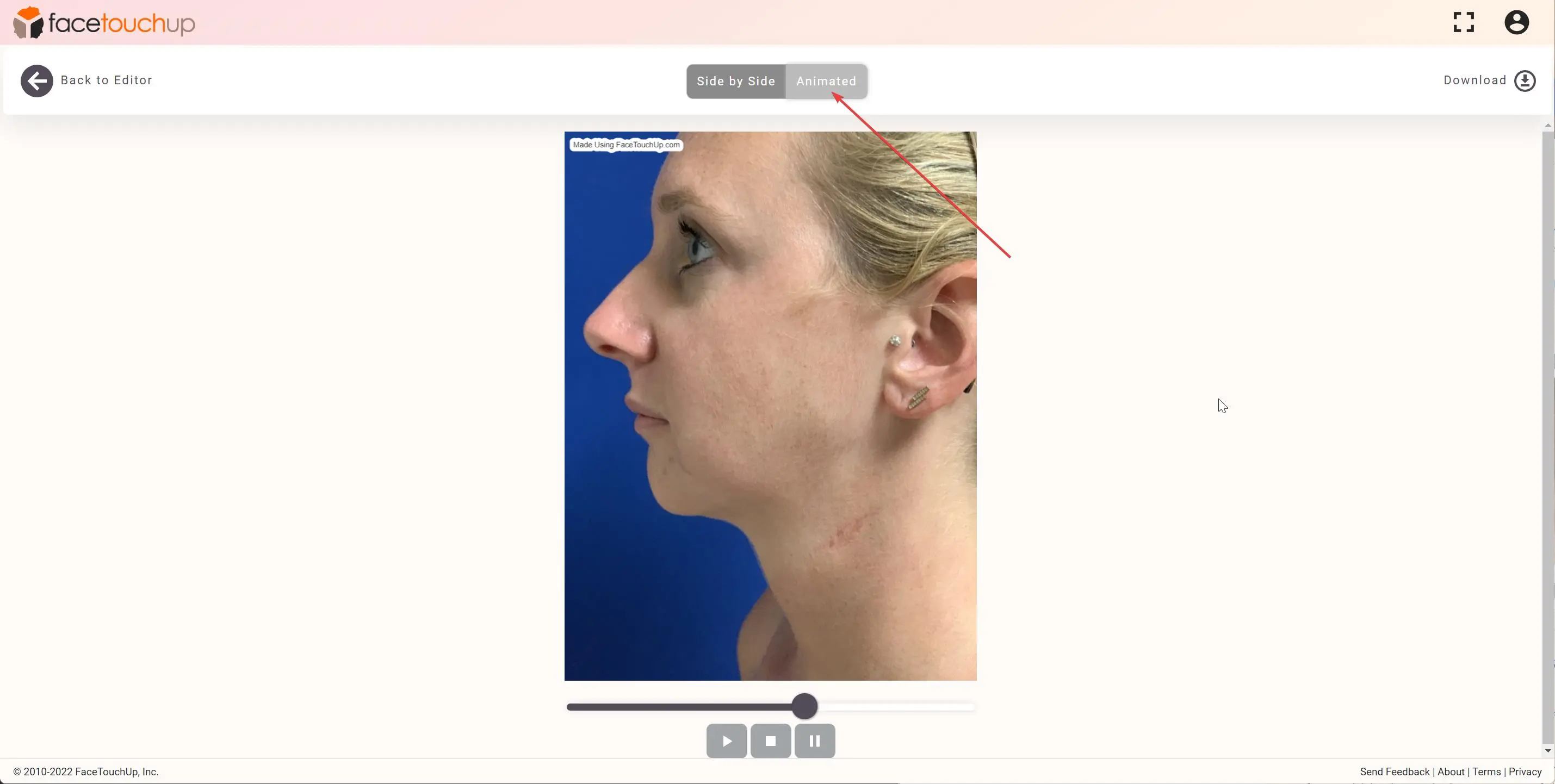 How to simulate rhinoplasty step 6