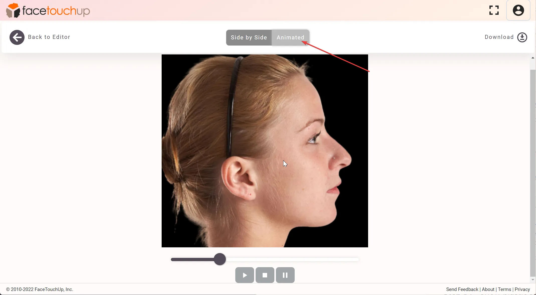 FaceTouchUp rhinoplasty simulator - Step 6: Fine-tune the nose profile
