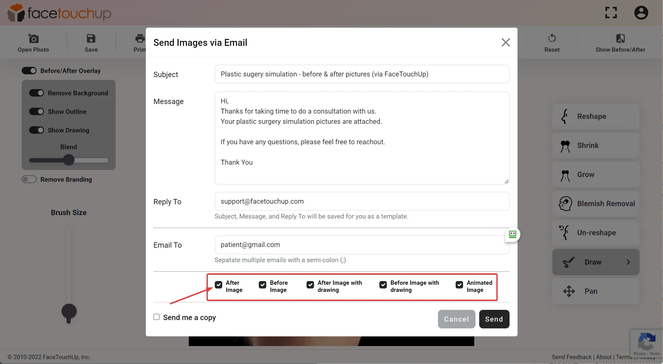 FaceTouchUp rhinoplasty simulator - Step 8: Review the before and after comparison