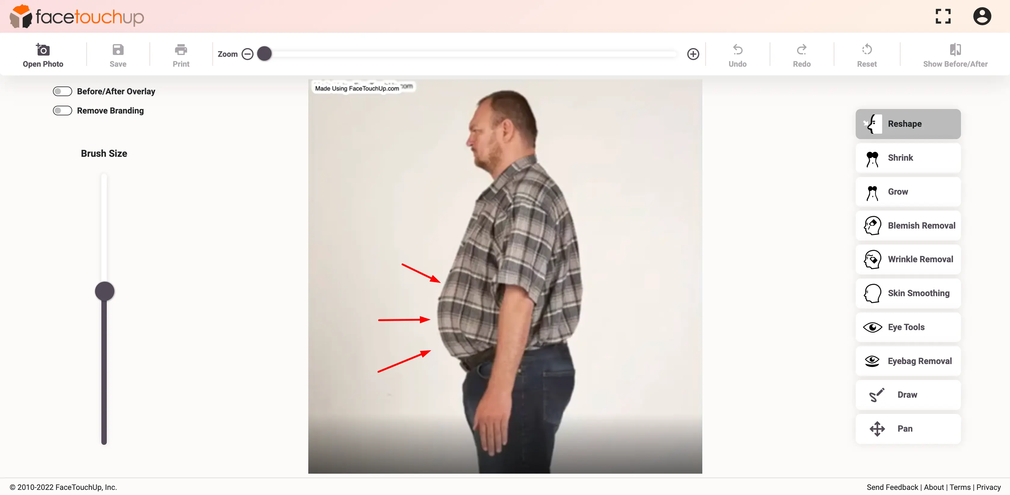 FaceTouchUp bariatric surgery simulator - Step 5: Adjust the arm contour