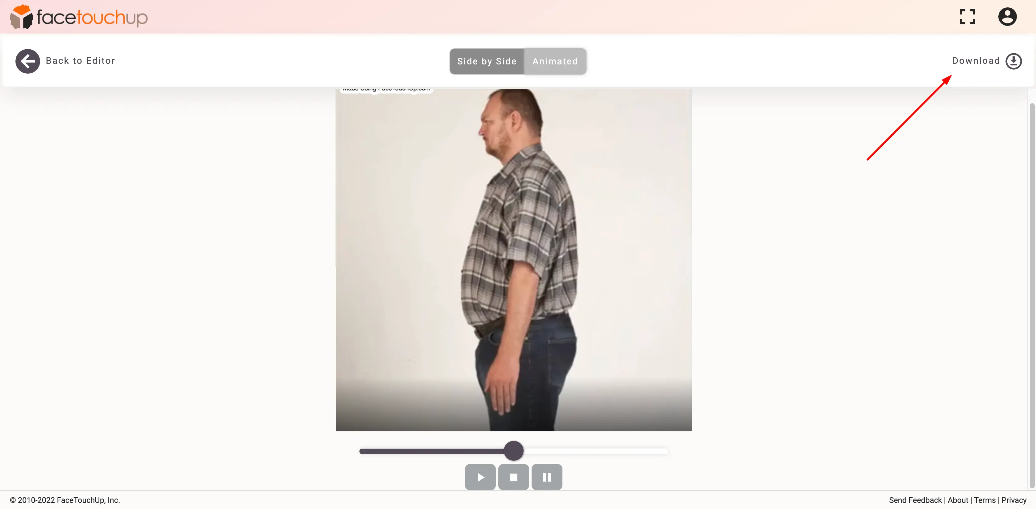 FaceTouchUp bariatric surgery simulator - Step 9: Save bariatric surgery simulation