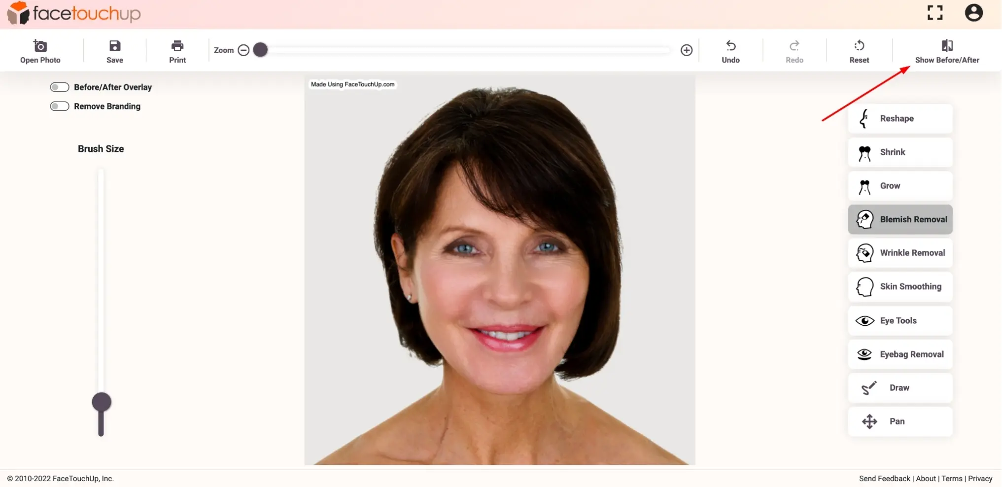FaceTouchUp face lift simulator - Step 11: Review before and after comparison